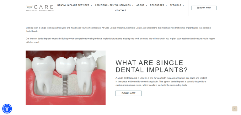 Single Dental Implants in Boise: Restore Your Smile with Expert Care